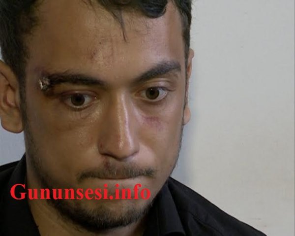 Sumqayıtda Ukrayna vətəndaşı kafe işçisini bıçaqladı – FOTOLAR