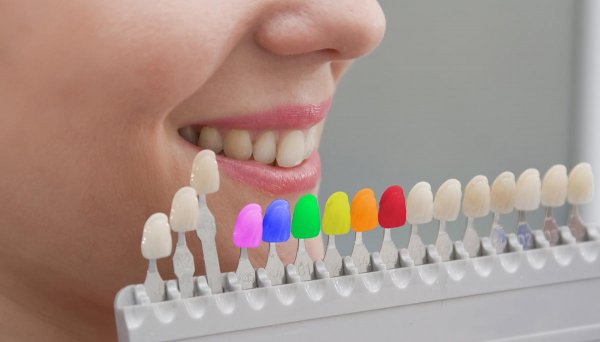 Dişlərdə karies niyə yaranır?