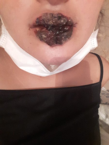 Azərbaycanlı qız kosmetoloqa getdi: Onu bu hala saldılar - FOTOLAR