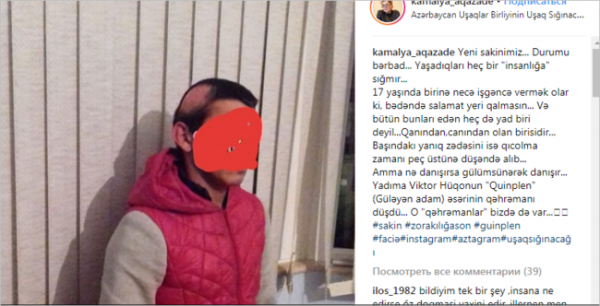 Azərbaycanda 17 yaşlı oğlanın dərisini soydular - FOTO