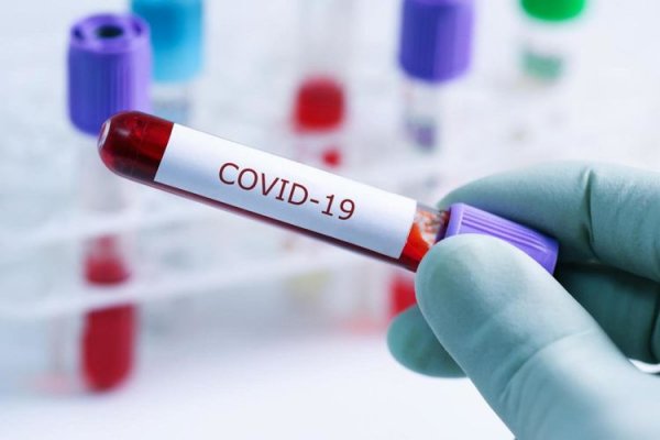 Rusiyada koronavirusdan ilk ölüm halı qeydə alınıb
