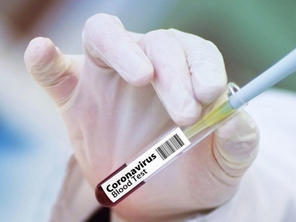 “Elə insan var, koronavirusa yoluxduğundan xəbəri olmur”- Simptomsuz xəstəliyi necə bilməli?