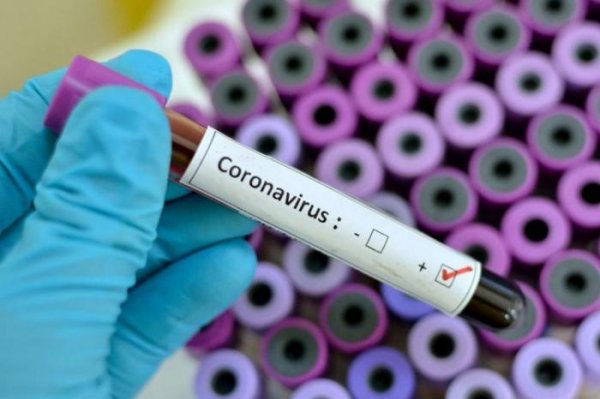 TƏBİB ölkədə koronavirusla bağlı son vəziyyəti açıqladı - STATİSTİKA