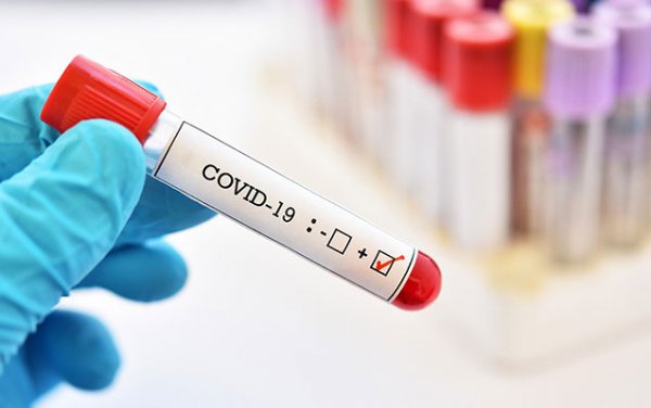 Azərbaycanda daha 131 nəfər koronavirusa yoluxdu - ölən var