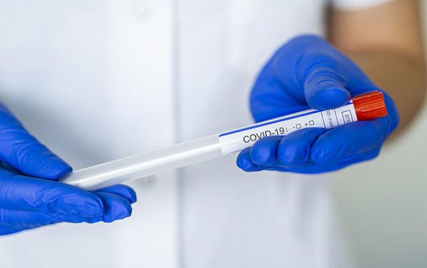 Azərbaycanda daha 191 nəfər koronavirusa yoluxdu - 2 nəfər öldü
