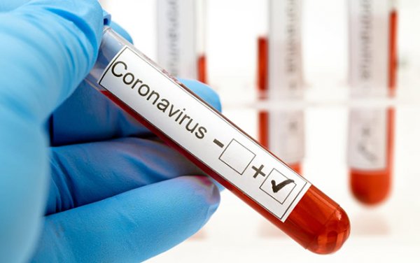 Azərbaycanda daha 588 nəfər koronavirusa yoluxdu - 7 pasiyent öldü 