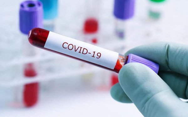 Daha 523 nəfərdə koronavirus aşkarlandı - 9 pasiyent öldü