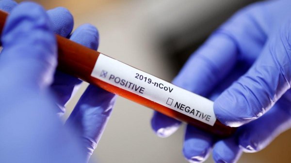 Azərbaycanda daha 526 nəfər koronavirusa yoluxdu - 8 nəfər öldü