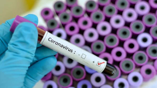 279 nəfər koronavirusa yoluxdu, 592 nəfər sağaldı