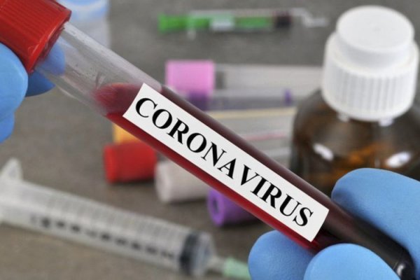 Azərbaycanda daha 97 nəfər koronavirusa yoluxdu - Ölənlər var