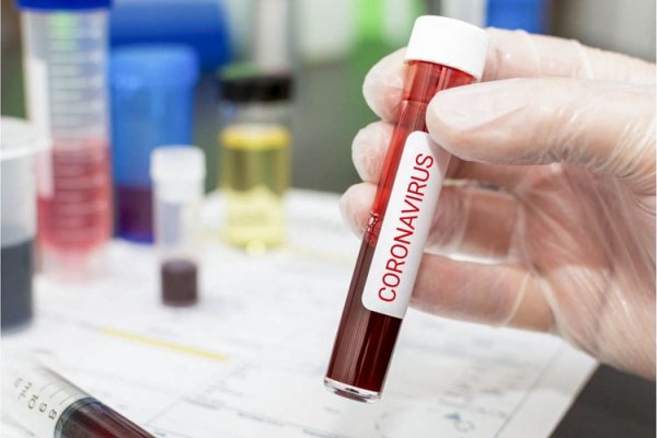 Bakıda 5 müəllimdə koronavirus aşkarlandı