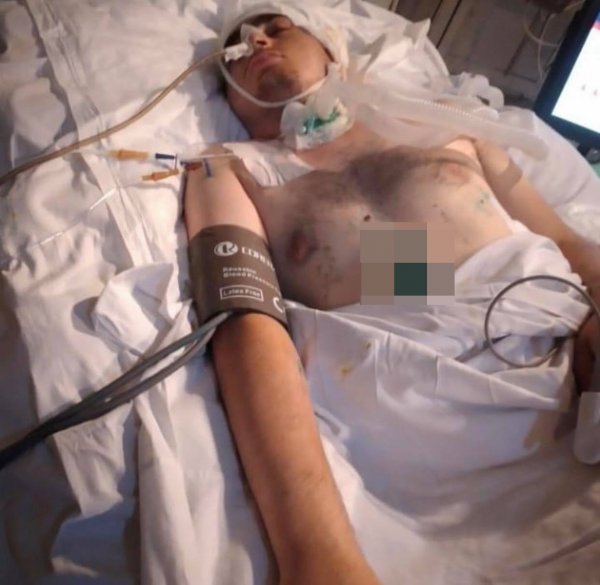 Sumqayıtlı qazi 128 gün davam edən komadan sonra vəfat edib - FOTO