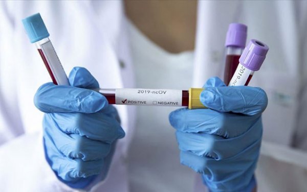 Azərbaycanda daha 23 nəfər koronavirusdan öldü - 1058 yeni yoluxma