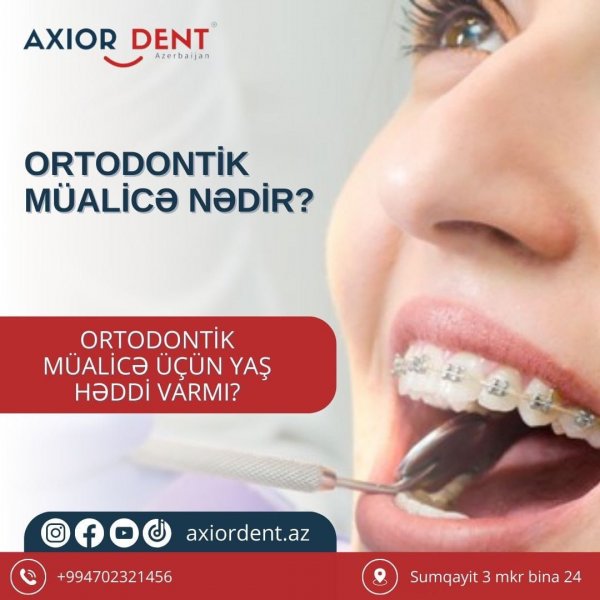 Ortodontik müalicə nədir? – Stomatoloq məsləhəti