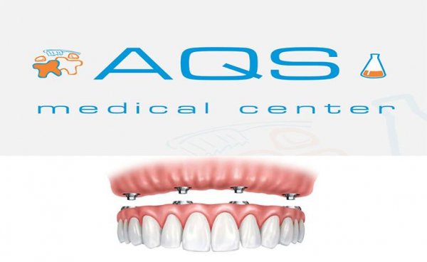 "AQS dental center" tövsiyə edir: Dişlərin çəkilməsi  və eyni seansda implantasiya