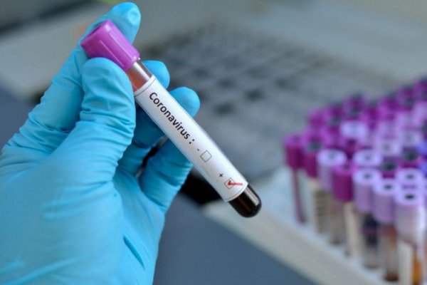 Azərbaycanda daha 17 nəfər koronavirusa yoluxdu - 1 nəfər öldü