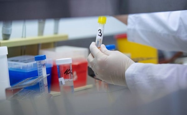 Azərbaycanda daha 28 nəfərdə koronavirus aşkarlandı