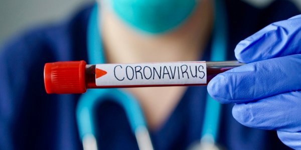 Azərbaycanda daha 49 nəfərdə koronavirus aşkarlandı - 1 nəfər öldü, 46 nəfər sağaldı 