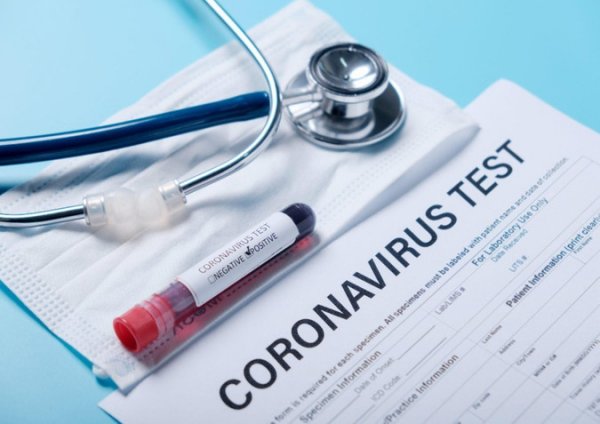 Azərbaycanda daha 113 nəfər koronavirusa yoluxub -1 nəfər vəfat edib