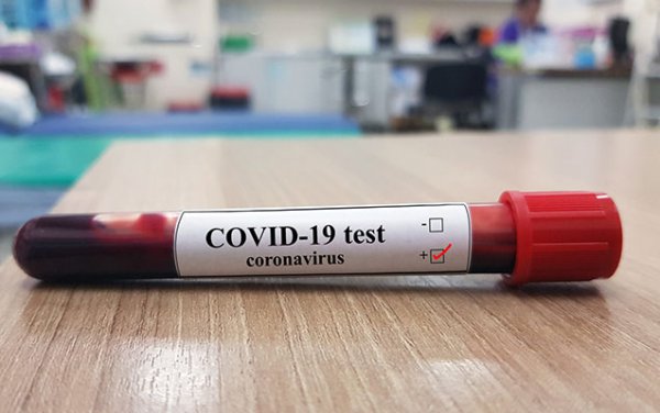 Bir sutkada koronavirusdan 18 nəfər vəfat etdi