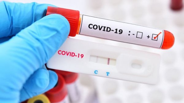 Koronavirus STATİSTİKASI:On test verəndən birində yoluxma aşkarlanıb