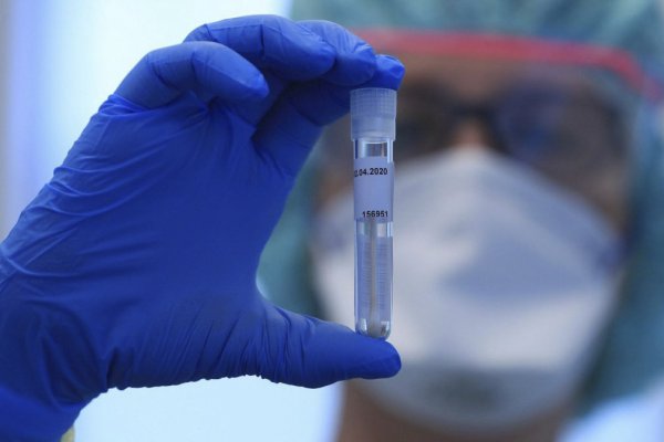 Azərbaycanda koronavirusdan daha 45 nəfər öldü - 3 759 yeni yoluxma