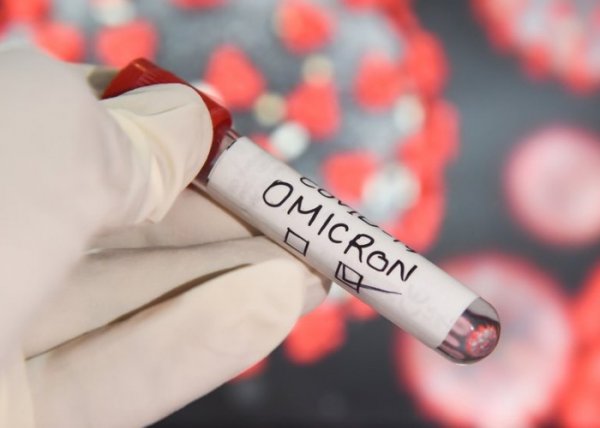 Vətəndaşlardan "Omicron" testinin götürülməsi ilə bağlı RƏSMİ AÇIQLAMA
